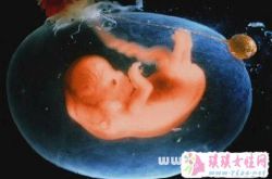 梦见堕胎打胎