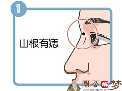 鼻子上的痣有什么意义 代表了什么