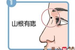 鼻子上的痣有什么意义 代表了什么