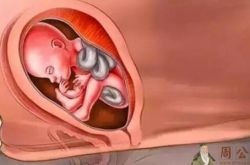 孕妇梦见胎儿脚从肚子里伸出来了